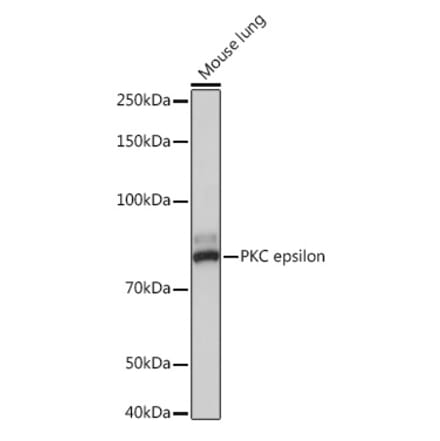 Western Blot - Anti-PKC epsilon Antibody [ARC1270] (A308554) - Antibodies.com
