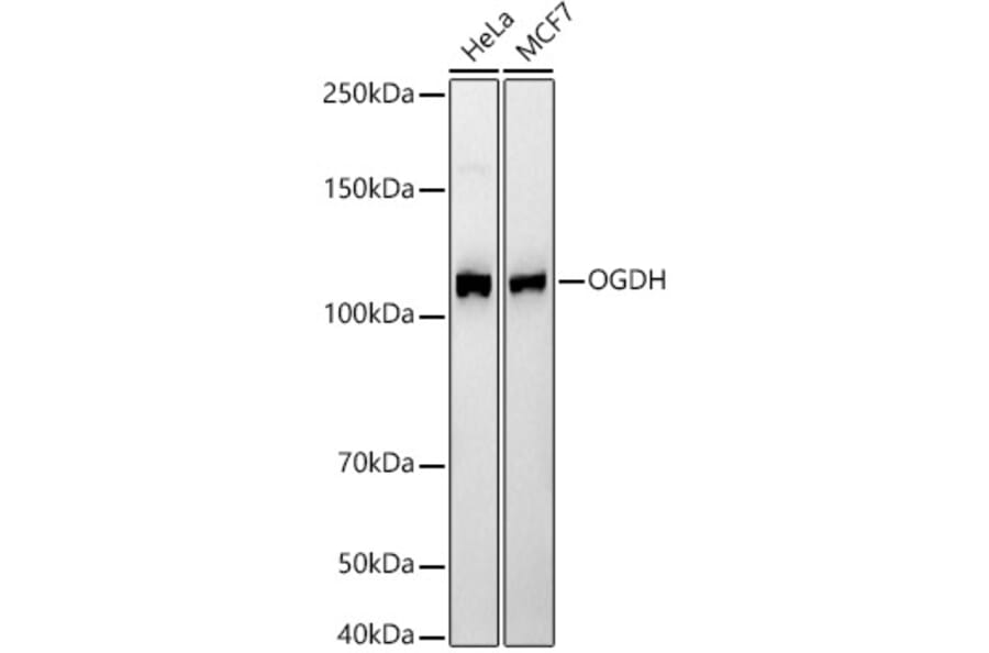 Western Blot - Anti-OGDH Antibody [ARC55379] (A308555) - Antibodies.com