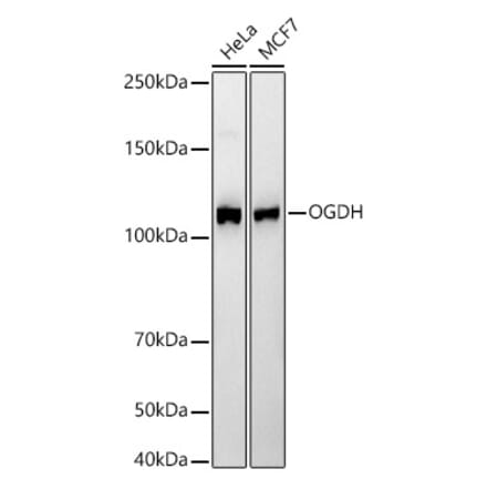 Western Blot - Anti-OGDH Antibody [ARC55379] (A308555) - Antibodies.com
