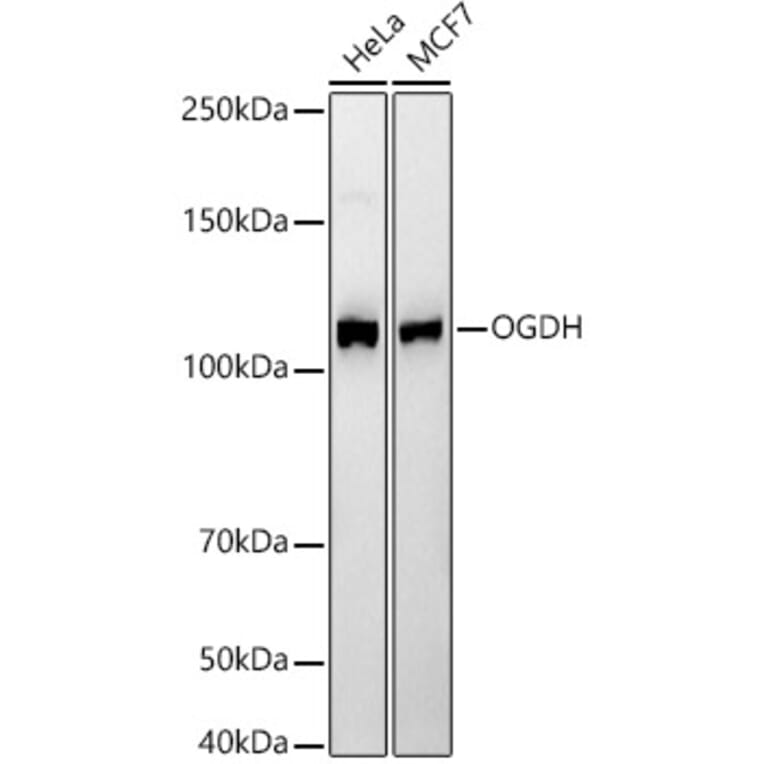 Western Blot - Anti-OGDH Antibody [ARC55379] (A308555) - Antibodies.com