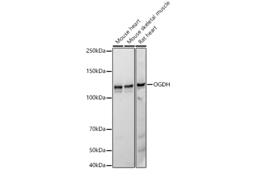 Western Blot - Anti-OGDH Antibody [ARC55379] (A308555) - Antibodies.com