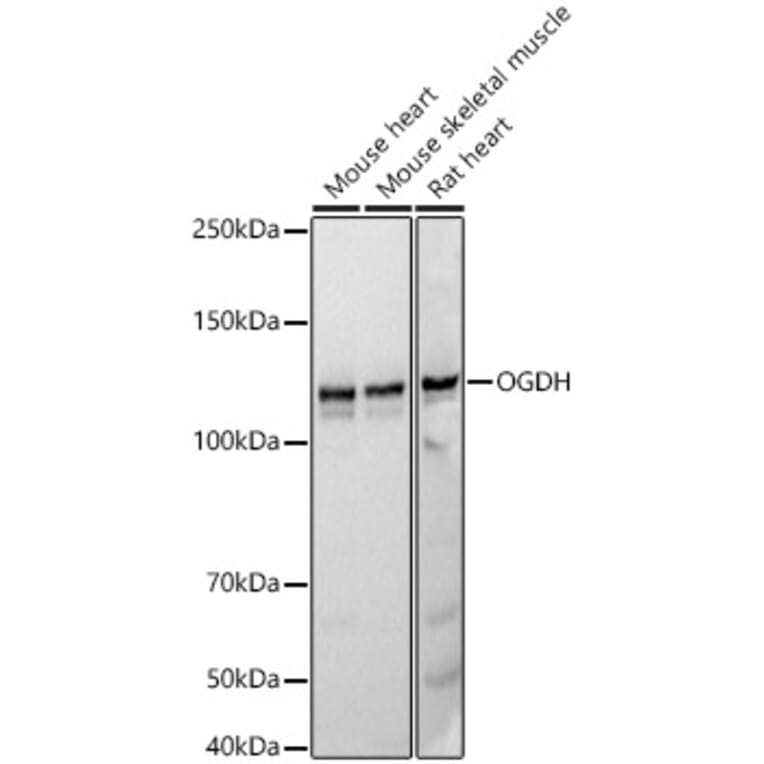 Western Blot - Anti-OGDH Antibody [ARC55379] (A308555) - Antibodies.com