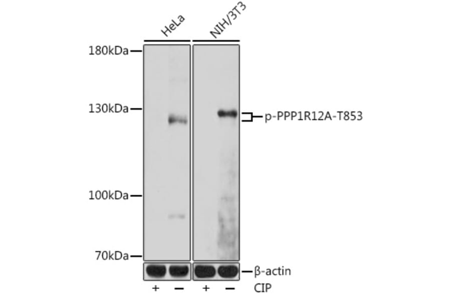 Western Blot - Anti-Myosin Phosphatase (phospho Thr853) Antibody (A308556) - Antibodies.com
