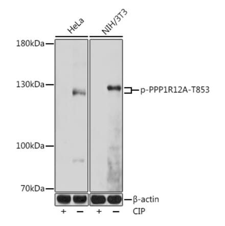 Western Blot - Anti-Myosin Phosphatase (phospho Thr853) Antibody (A308556) - Antibodies.com