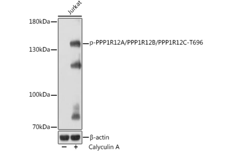 Western Blot - Anti-Myosin Phosphatase + PPP1R12B + PPP1R12C (phospho Thr696) Antibody (A308557) - Antibodies.com