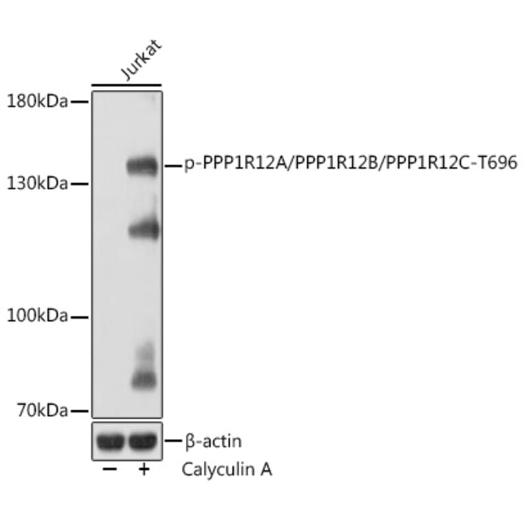Western Blot - Anti-Myosin Phosphatase + PPP1R12B + PPP1R12C (phospho Thr696) Antibody (A308557) - Antibodies.com