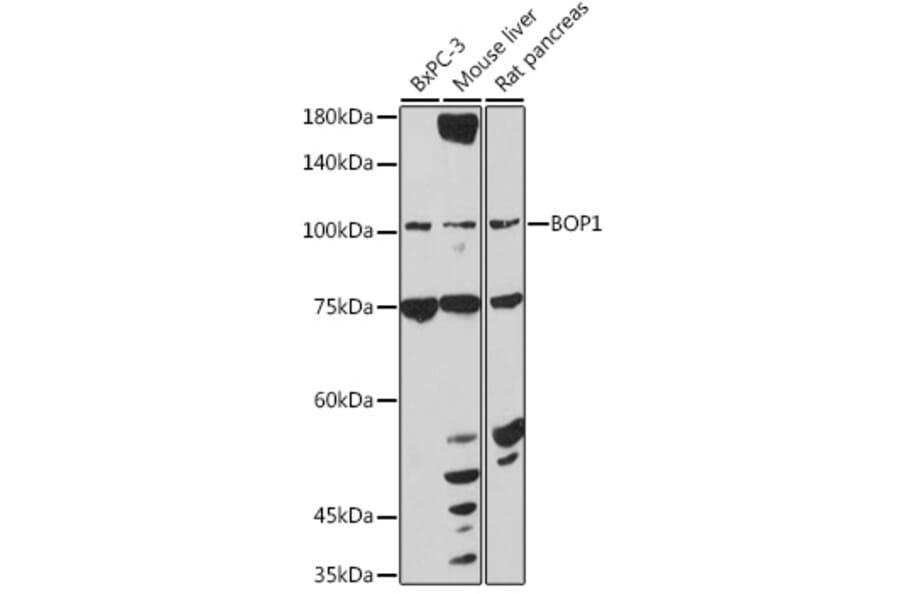 Western Blot - Anti-BOP1 Antibody (A308558) - Antibodies.com