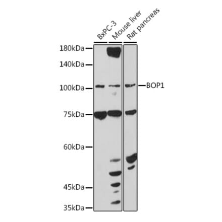 Western Blot - Anti-BOP1 Antibody (A308558) - Antibodies.com