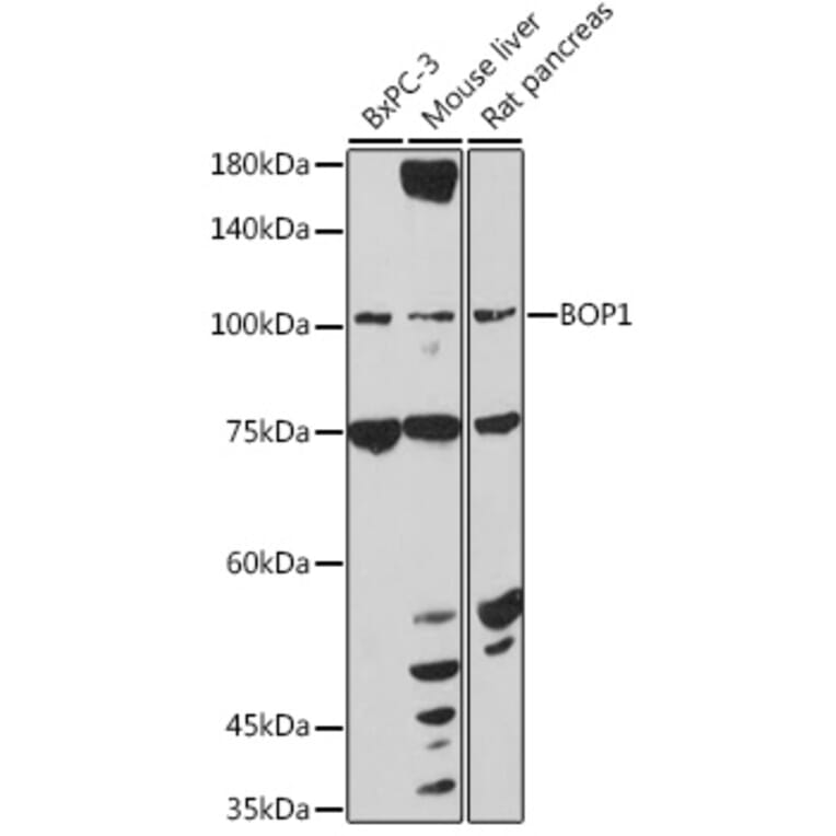 Western Blot - Anti-BOP1 Antibody (A308558) - Antibodies.com