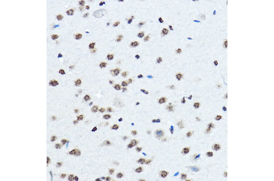 Immunohistochemistry - Anti-BOP1 Antibody (A308558) - Antibodies.com