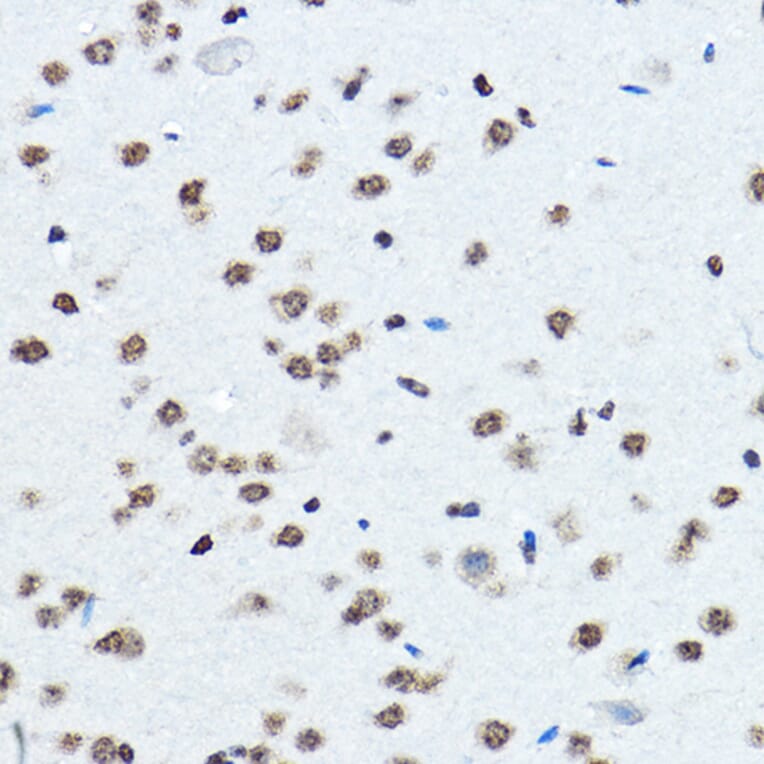 Immunohistochemistry - Anti-BOP1 Antibody (A308558) - Antibodies.com