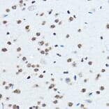 Immunohistochemistry - Anti-BOP1 Antibody (A308558) - Antibodies.com
