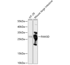 Western Blot - Anti-FAM3D Antibody (A308559) - Antibodies.com