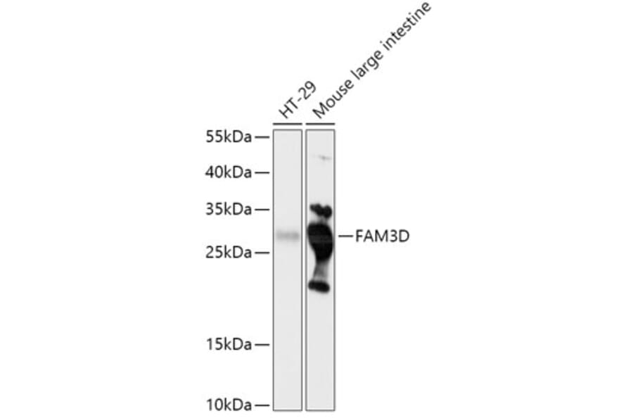Western Blot - Anti-FAM3D Antibody (A308559) - Antibodies.com