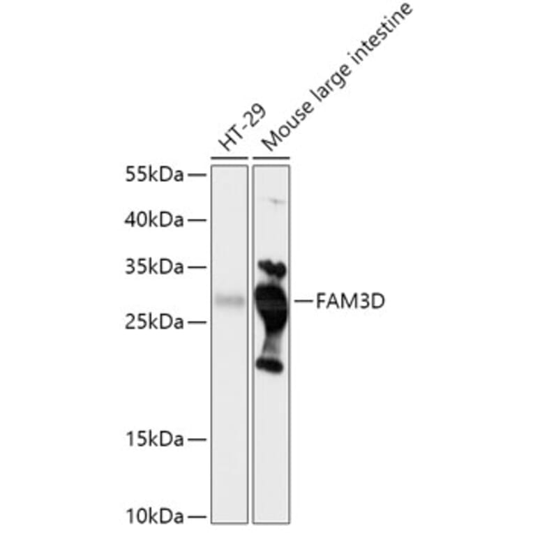 Western Blot - Anti-FAM3D Antibody (A308559) - Antibodies.com