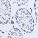 Immunohistochemistry - Anti-FAM3D Antibody (A308559) - Antibodies.com