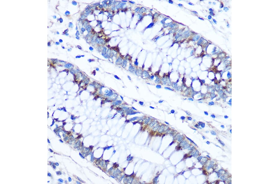 Immunohistochemistry - Anti-FAM3D Antibody (A308559) - Antibodies.com