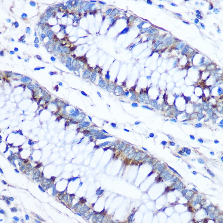 Immunohistochemistry - Anti-FAM3D Antibody (A308559) - Antibodies.com