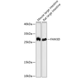 Western Blot - Anti-FAM3D Antibody (A308560) - Antibodies.com