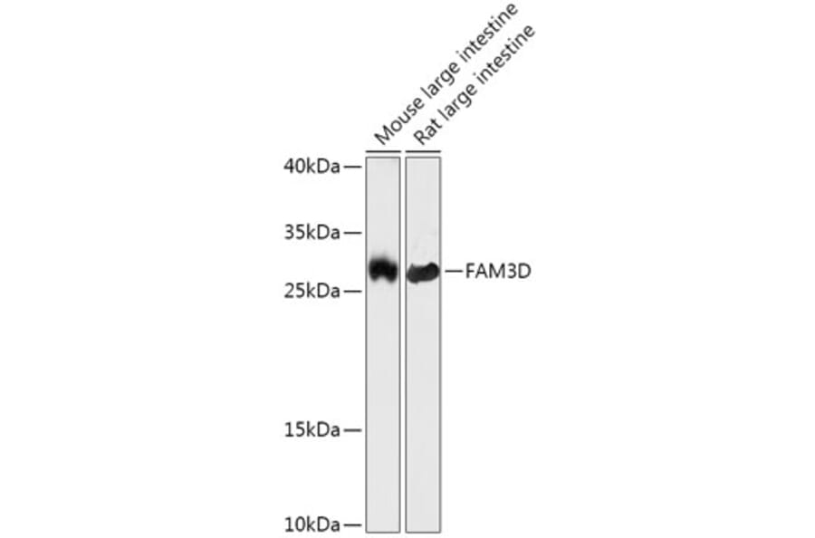 Western Blot - Anti-FAM3D Antibody (A308560) - Antibodies.com