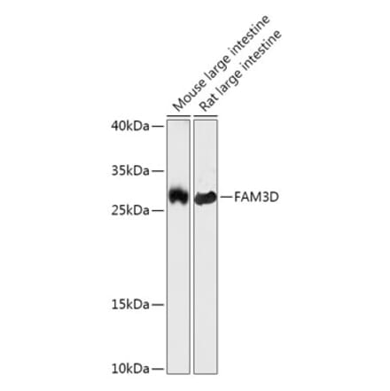 Western Blot - Anti-FAM3D Antibody (A308560) - Antibodies.com