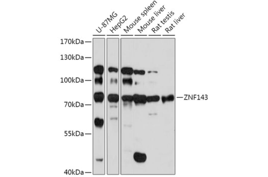 Western Blot - Anti-ZNF143/SBF Antibody (A308561) - Antibodies.com