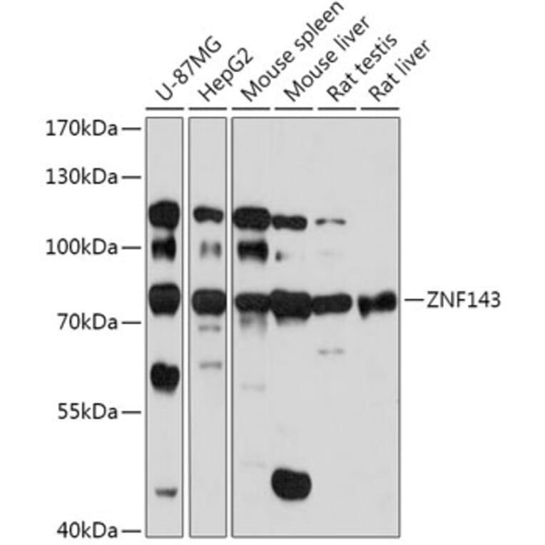 Western Blot - Anti-ZNF143/SBF Antibody (A308561) - Antibodies.com