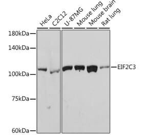 Western Blot - Anti-AGO3 Antibody [ARC2345] (A308562) - Antibodies.com
