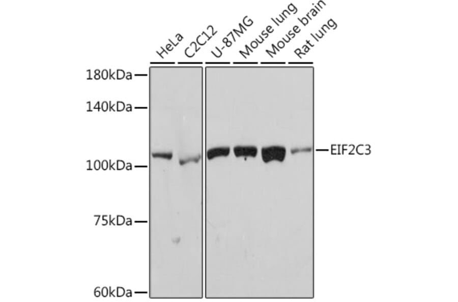 Western Blot - Anti-AGO3 Antibody [ARC2345] (A308562) - Antibodies.com