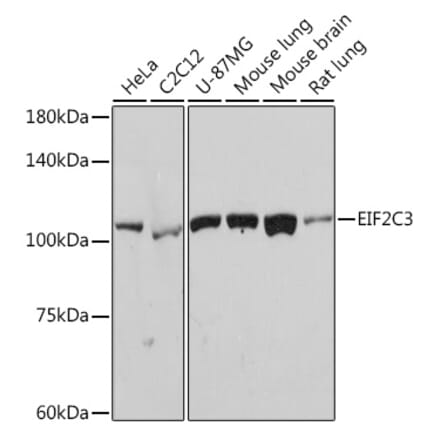 Western Blot - Anti-AGO3 Antibody [ARC2345] (A308562) - Antibodies.com