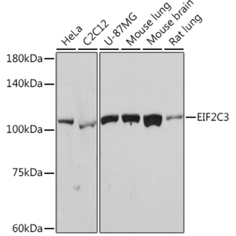 Western Blot - Anti-AGO3 Antibody [ARC2345] (A308562) - Antibodies.com