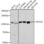 Western Blot - Anti-AGO3 Antibody [ARC2345] (A308562) - Antibodies.com