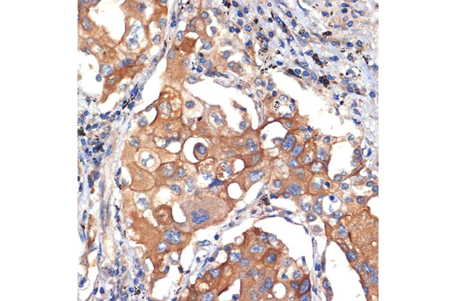 Immunohistochemistry - Anti-AGO3 Antibody [ARC2345] (A308562) - Antibodies.com