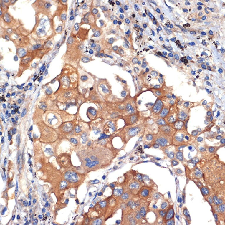 Immunohistochemistry - Anti-AGO3 Antibody [ARC2345] (A308562) - Antibodies.com