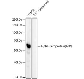 Western Blot - Anti-alpha 1 Fetoprotein Antibody [ARC54866] (A308567) - Antibodies.com