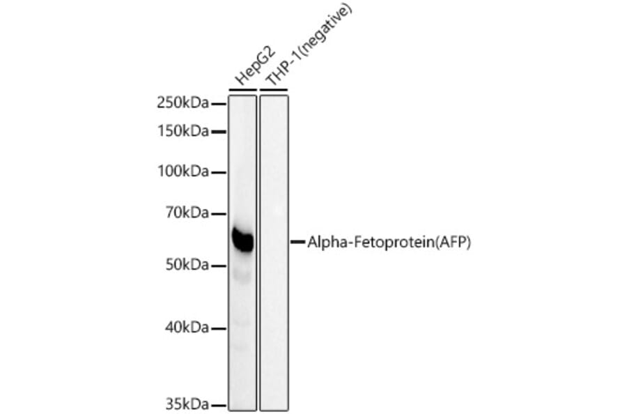 Western Blot - Anti-alpha 1 Fetoprotein Antibody [ARC54866] (A308567) - Antibodies.com