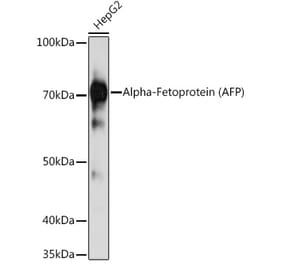 Western Blot - Anti-alpha 1 Fetoprotein Antibody [AMC0201] (A308568) - Antibodies.com
