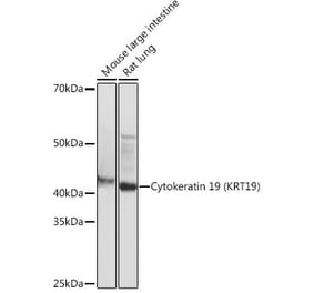 Western Blot - Anti-Cytokeratin 19 Antibody [ARC0272] (A308569) - Antibodies.com