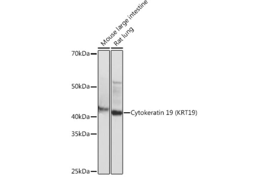 Western Blot - Anti-Cytokeratin 19 Antibody [ARC0272] (A308569) - Antibodies.com