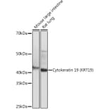 Western Blot - Anti-Cytokeratin 19 Antibody [ARC0272] (A308569) - Antibodies.com