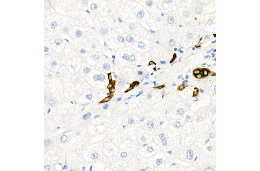 Immunohistochemistry - Anti-Cytokeratin 19 Antibody [ARC0272] (A308569) - Antibodies.com