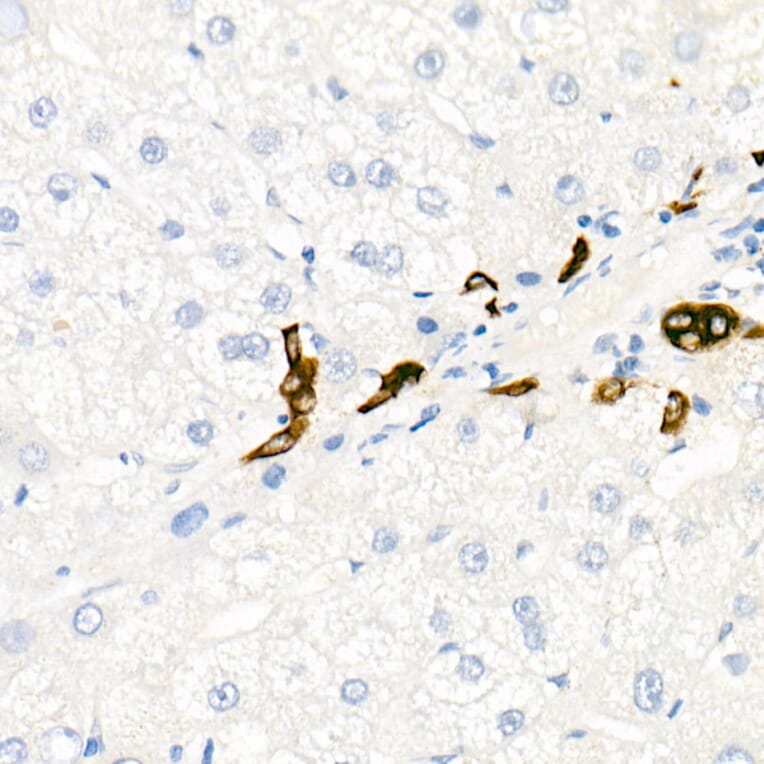 Immunohistochemistry - Anti-Cytokeratin 19 Antibody [ARC0272] (A308569) - Antibodies.com