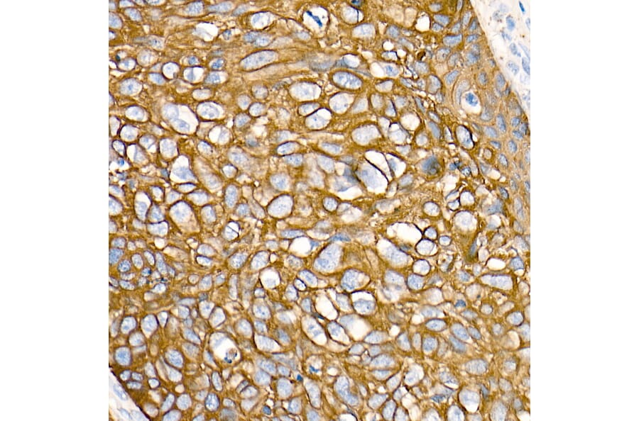 Immunohistochemistry - Anti-Cytokeratin 19 Antibody [ARC0272] (A308569) - Antibodies.com