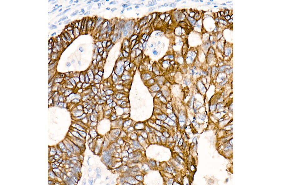 Immunohistochemistry - Anti-Cytokeratin 19 Antibody [ARC0272] (A308569) - Antibodies.com
