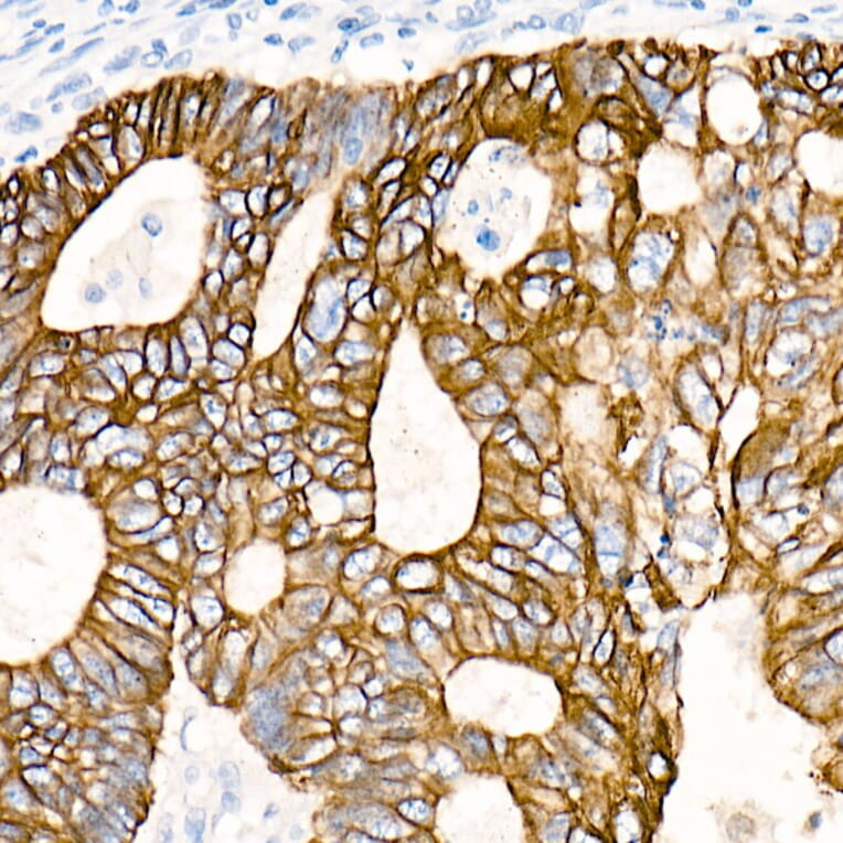 Immunohistochemistry - Anti-Cytokeratin 19 Antibody [ARC0272] (A308569) - Antibodies.com