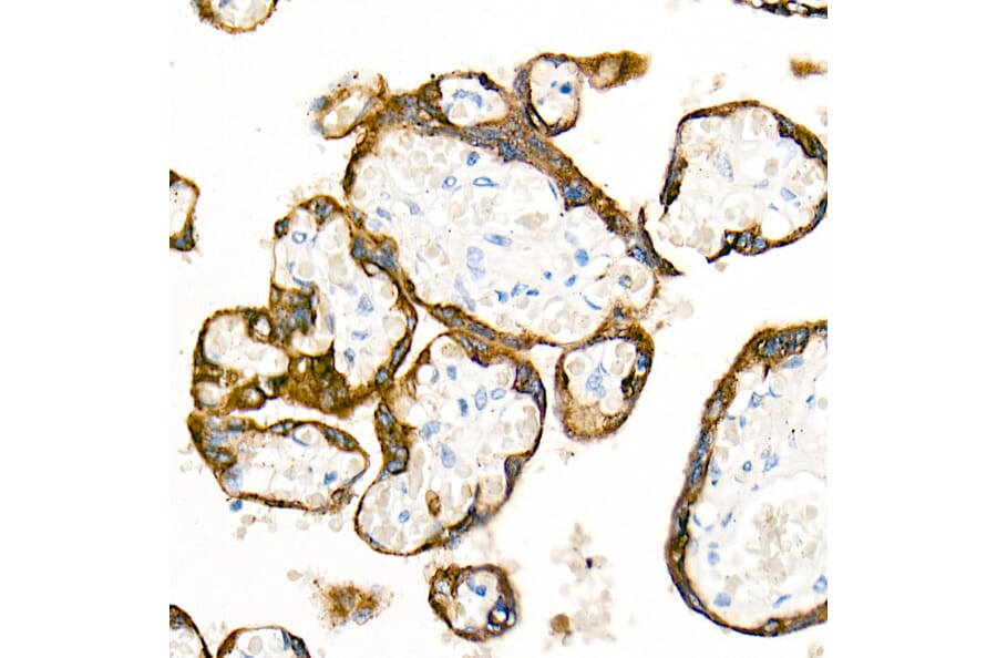 Immunohistochemistry - Anti-Cytokeratin 19 Antibody [ARC0272] (A308569) - Antibodies.com