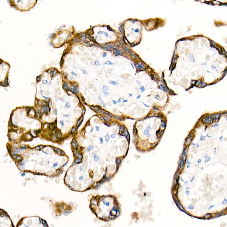 Immunohistochemistry - Anti-Cytokeratin 19 Antibody [ARC0272] (A308569) - Antibodies.com