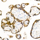 Immunohistochemistry - Anti-Cytokeratin 19 Antibody [ARC0272] (A308569) - Antibodies.com