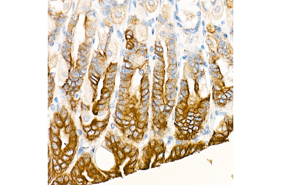 Immunohistochemistry - Anti-Cytokeratin 19 Antibody [ARC0272] (A308569) - Antibodies.com