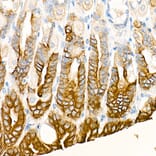 Immunohistochemistry - Anti-Cytokeratin 19 Antibody [ARC0272] (A308569) - Antibodies.com